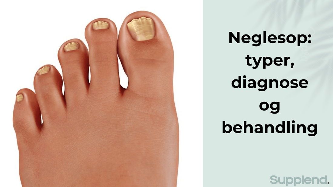 Neglesop: typer, diagnose og behandling