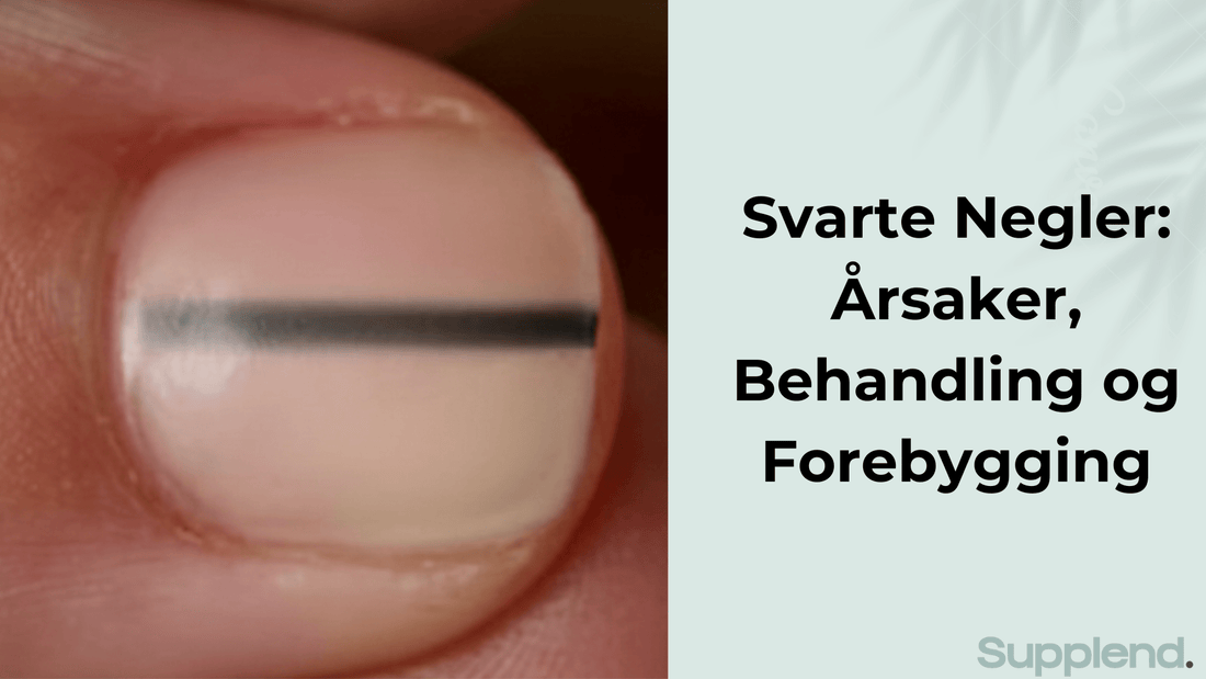 Svarte Negler: Årsaker, Behandling og Forebygging